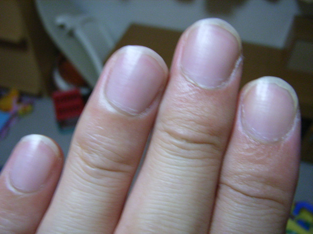 半月 ない 爪 爪の半月がないのは不調？指によって体からのメッセージは違った！
